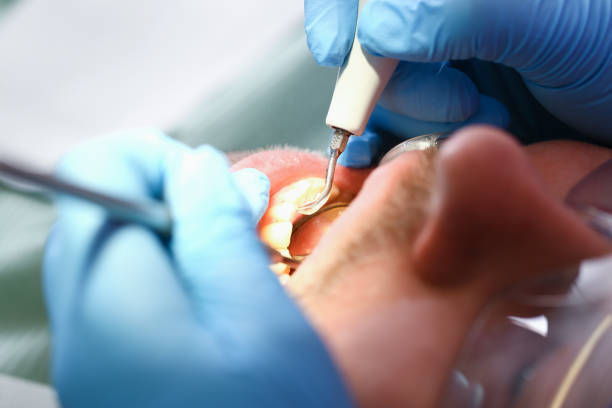 Best After-Hours Emergency Dentist in Peru, IN
