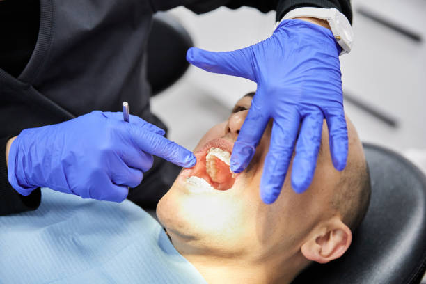 Best Emergency Root Canal Treatment in Peru, IN